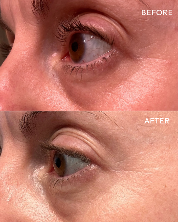Eye Hero Bio-Retinol Smoothing Eye Cream