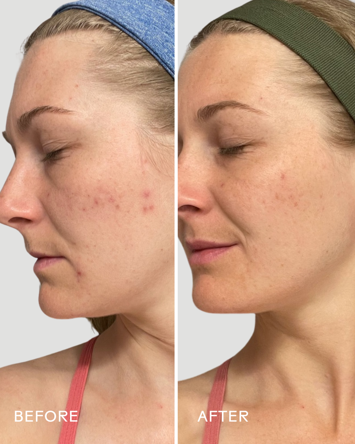 Refresh Papaya + Salicylic Acid Foaming Cleanser