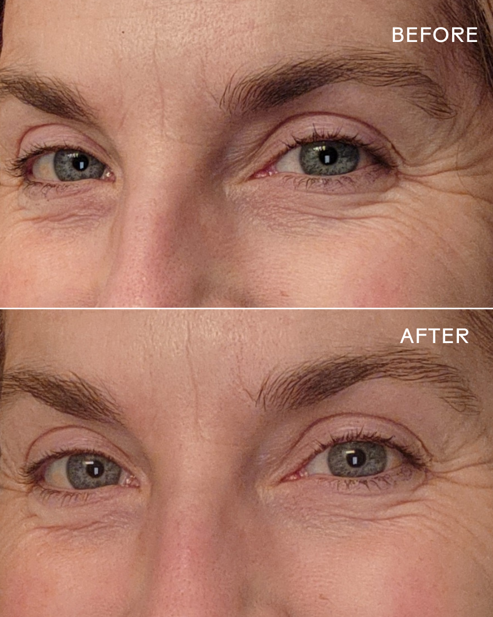Eye Hero Bio-Retinol Smoothing Eye Cream