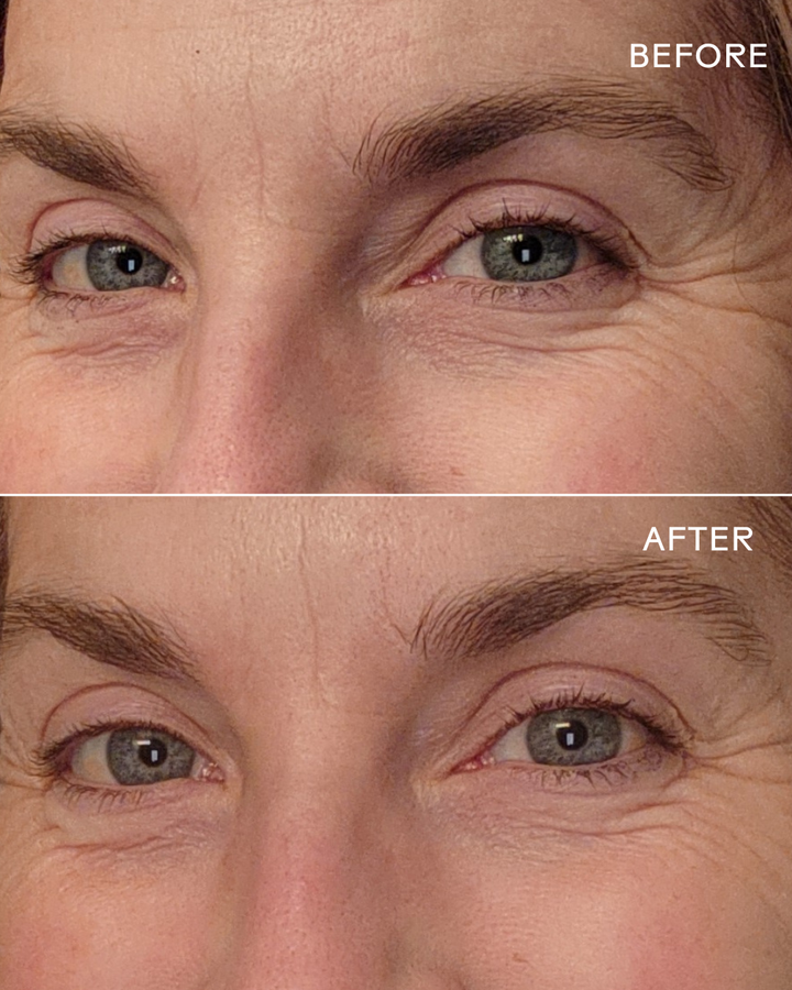 Eye Hero Bio-Retinol Smoothing Eye Cream